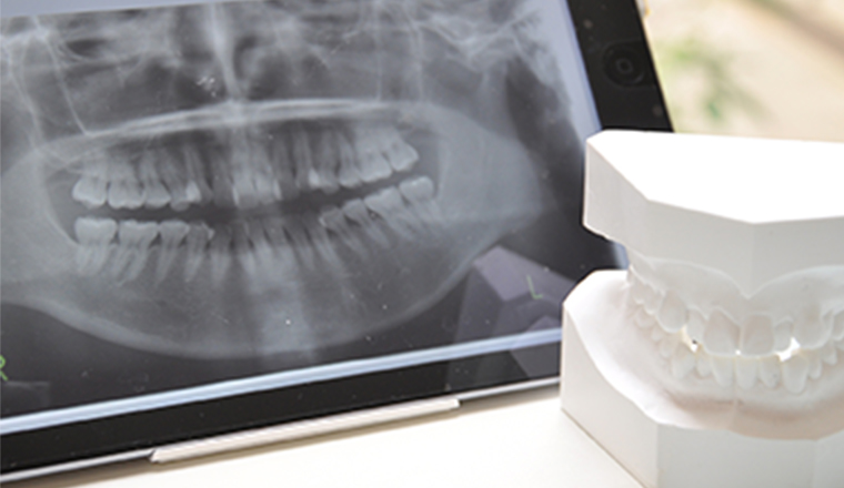 顎の骨が痩せにくい